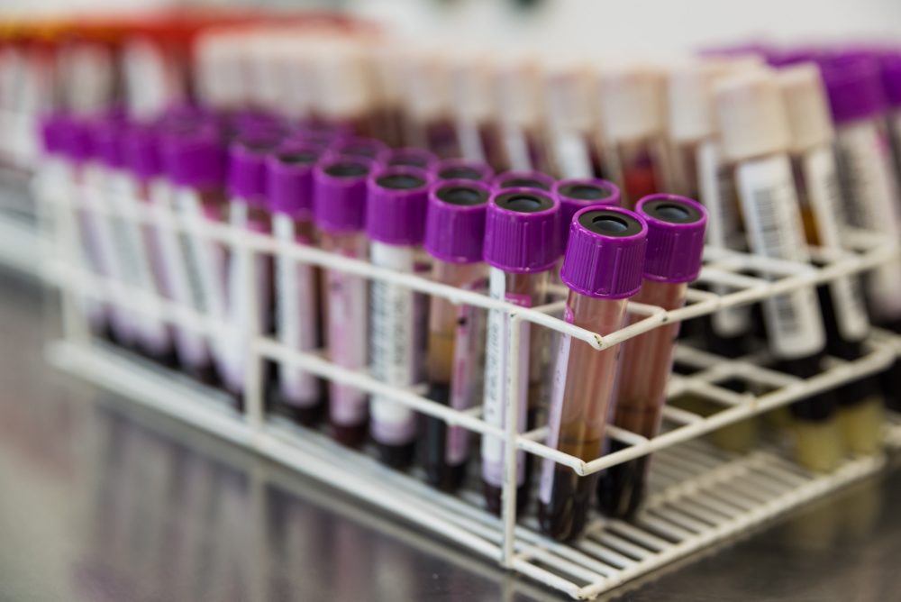 Doação de Sangue: estoque está no vermelho na Pró-Sangue