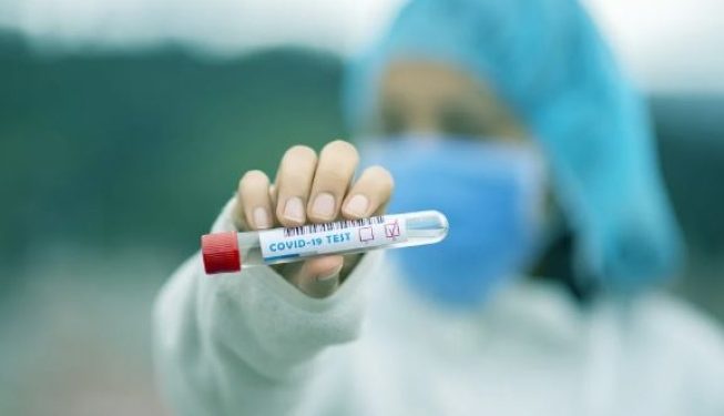 Capital tem 11% de pessoas com anticorpos para Covid-19