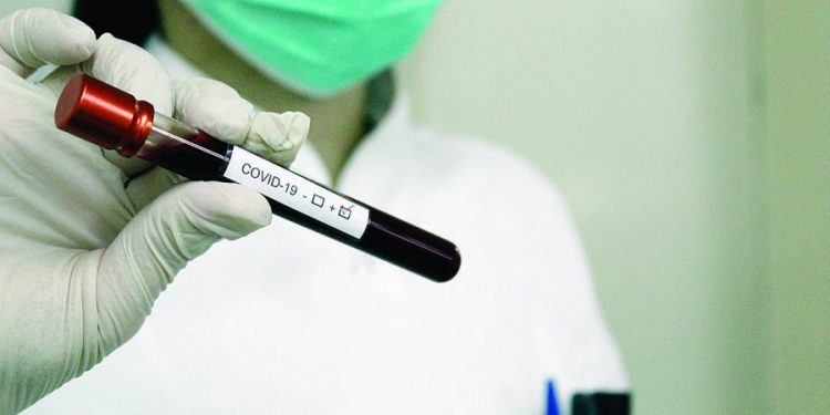 Região do Belém registra maior taxa de mortes por Covid-19 a cada 100 mil pessoas