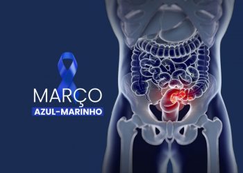 Diagnóstico precoce é essencial para a prevenção do câncer colorretal