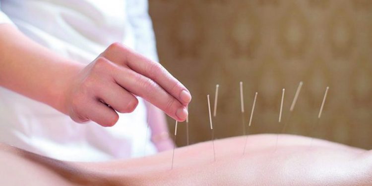 Procura por acupuntura e yoga nas UBSs sobe 55% com mais profissionais