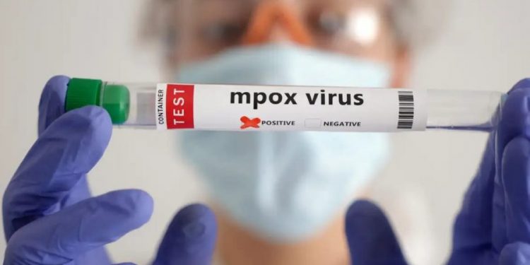 Mpox: OMS declara emergência de saúde pública global