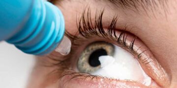Fim dos óculos? Colírio aprovado pela FDA corrige a visão de perto