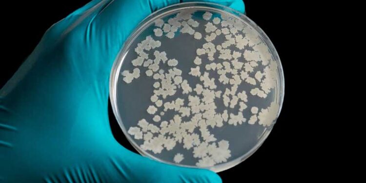 Uma em cada seis infecções bacterianas no mundo é resistente a antibióticos